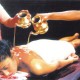 Ayurvedic Treatment Ayurvedic Treatment